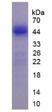 Human LMTK3 Protein (Recombinant His, N-Terminal)