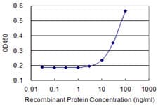 CSF2RA / CD116 Antibody (clone 2G5)