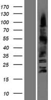 OLIG3 Protein (Over-Expression Lysate Myc-DDK (Flag))