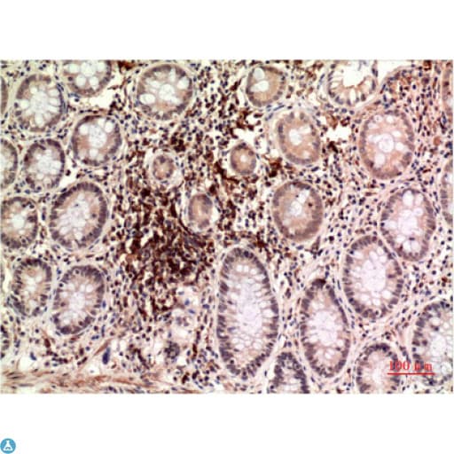 TUBE1 / Tubulin Epsilon Antibody