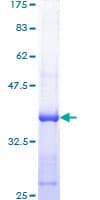 Human RPA70 / RPA1 Protein (Recombinant GST, N-terminus)
