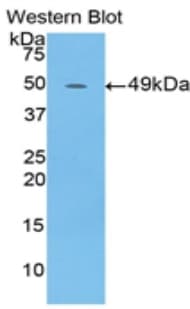 IFNA / Interferon Alpha Antibody (aa23-187)