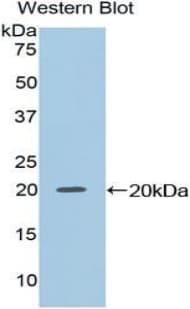 NME2 Antibody (aa8-149)