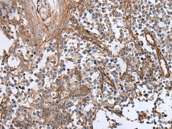 Polyclonal Rabbit anti-Human GHBP / BLVRB Antibody (IHC, WB)