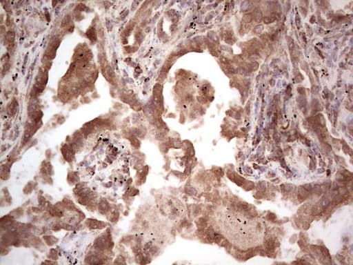 RET Antibody (aa713-1017, clone OTI20B8)