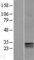 BP1 / DLX4 Protein (Over-Expression Lysate Myc-DDK (Flag))