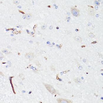 EGFR Antibody