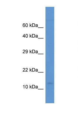 Polyclonal Rabbit anti-Human PCBD2 Antibody (aa30-79, WB)