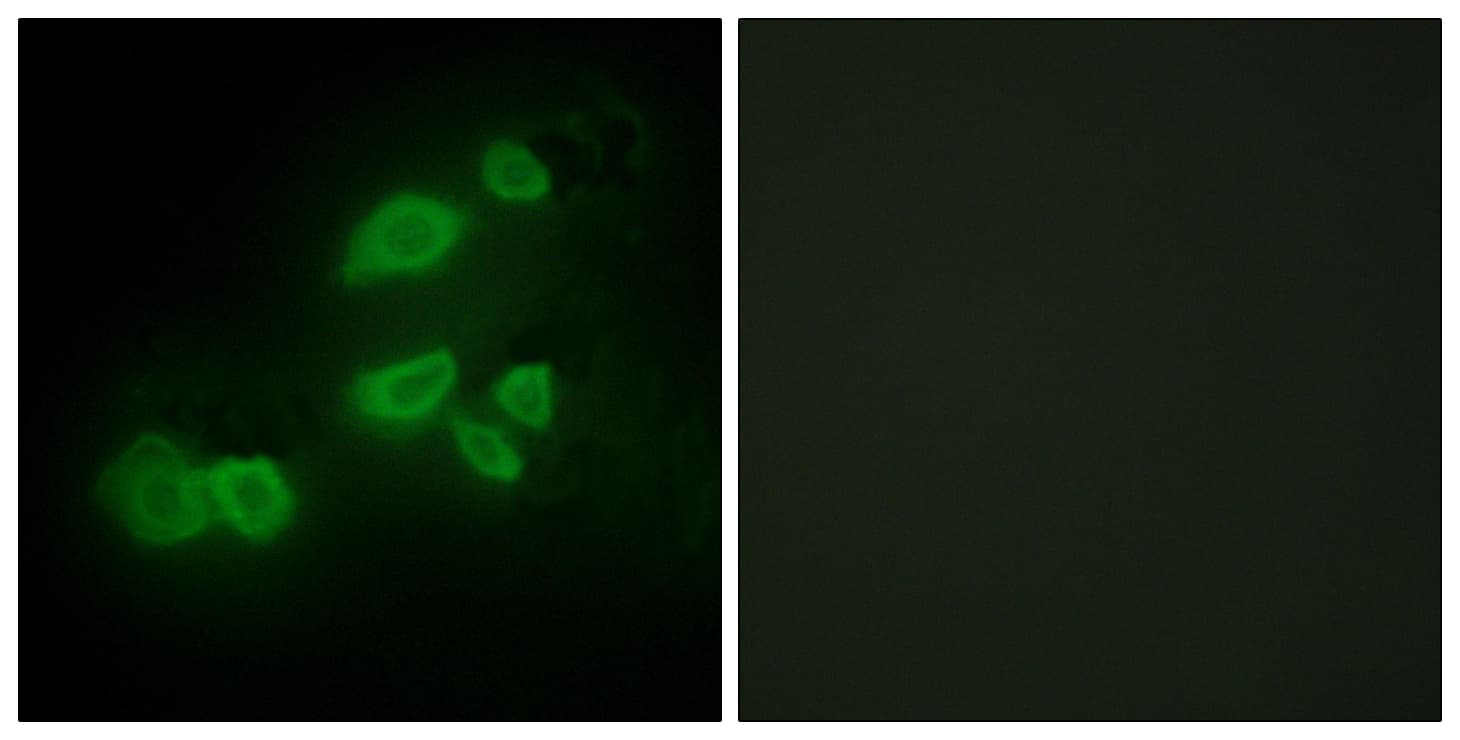 CDCP1 Antibody (aa691-740)
