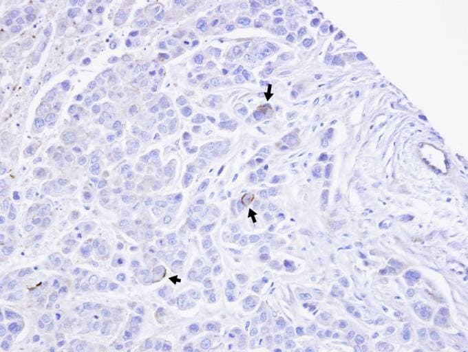 TRPM2 Antibody (aa181-423)