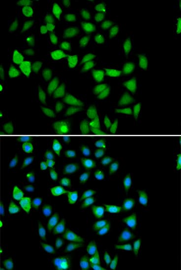 IHC-plus™ STAMBP / AMSH Antibody