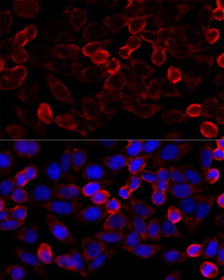 HDAC6 Antibody