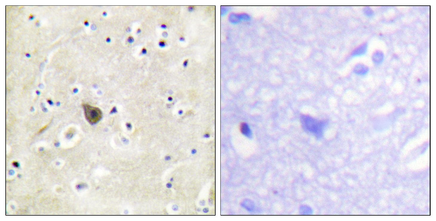 PRKD2 / PKD2 Antibody (p876)
