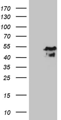 BCL7B Antibody (clone OTI3F6)