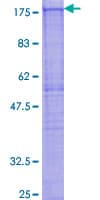 Human CYFIP2 / PIR121 Protein (Recombinant GST)