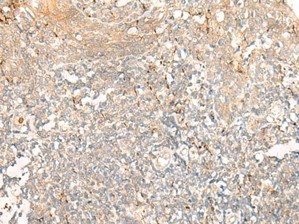 GCAT Antibody