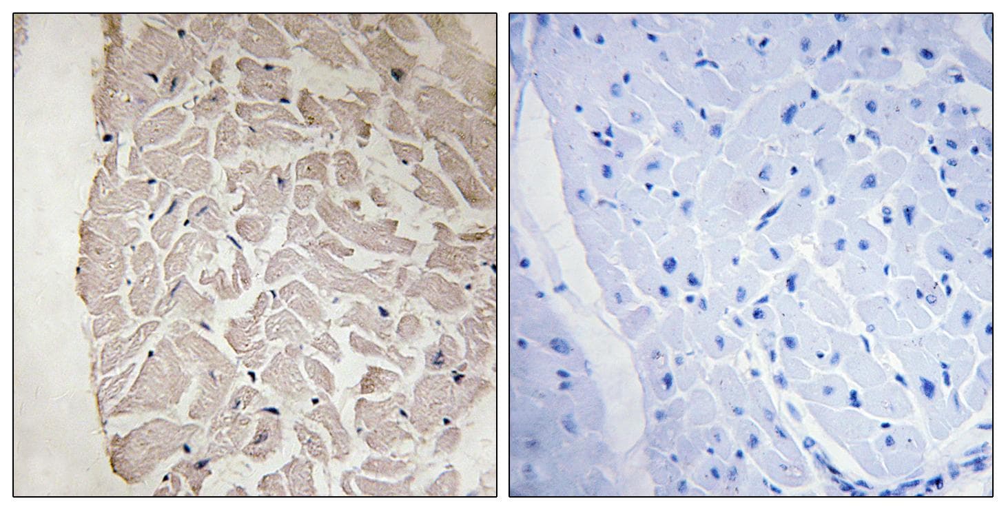 COL6A1 / Collagen VI Alpha 1 Antibody