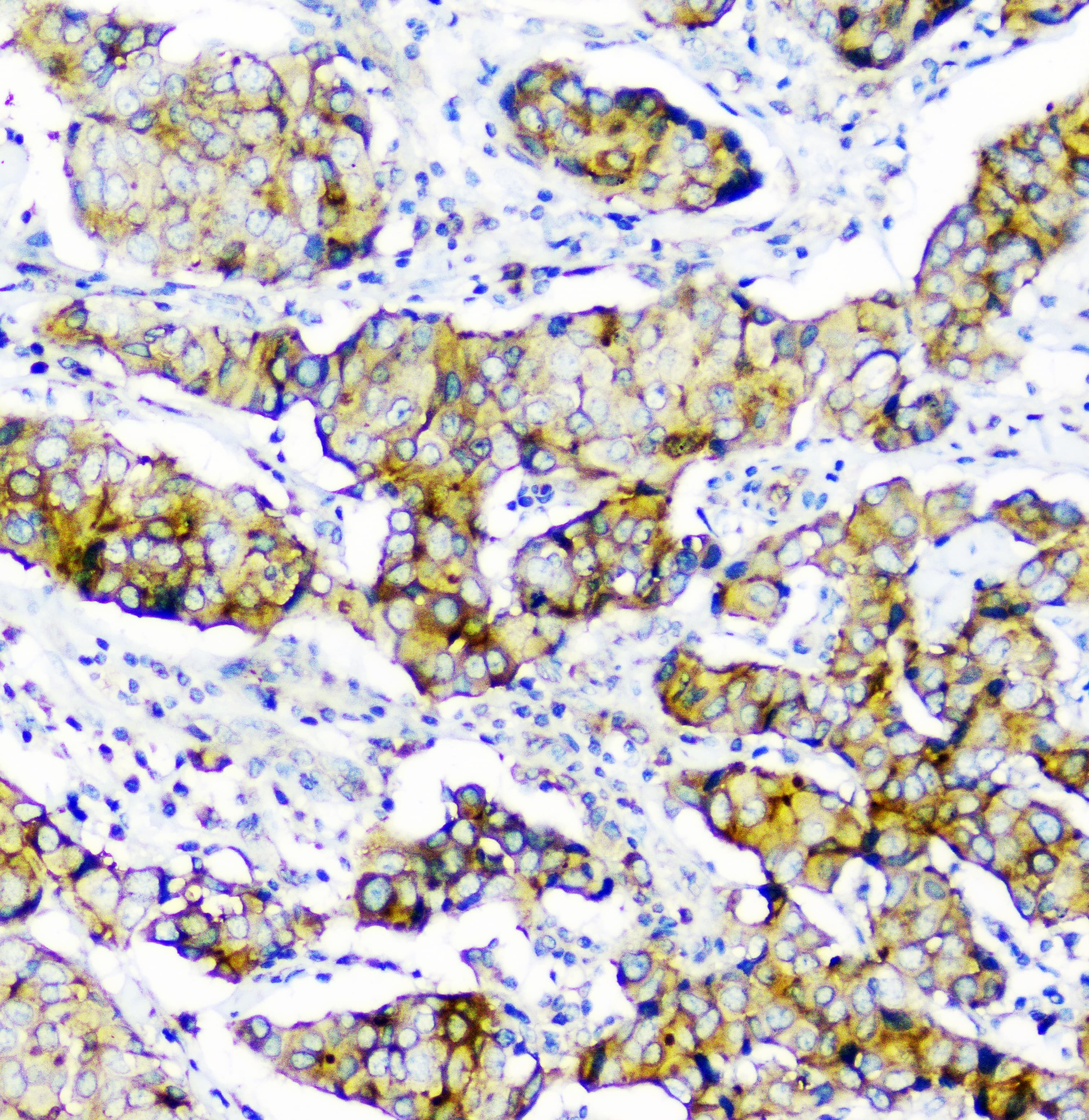 CD2AP Antibody