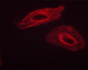 KRT8 / CK8 / Cytokeratin 8 Antibody (phospho-Ser432)