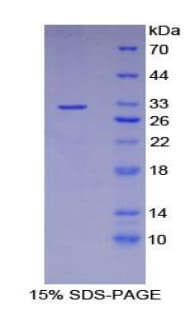 Human GSTO1 Protein (Recombinant His-T7)