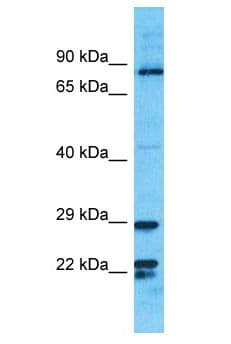 PIK3R3 / p85 Gamma Antibody (aa175-224)