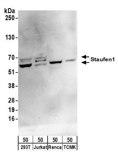 IHC-plus™ Polyclonal Rabbit anti-Human ARHGEF28 Antibody (aa1655-1705, IHC, WB)