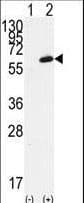 FGR Antibody (aa3-33)