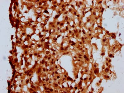 MKL2 Antibody