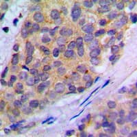 Polyclonal Rabbit anti-Human PLA2G4A Antibody (phospho-Ser505, IHC, IF, WB)