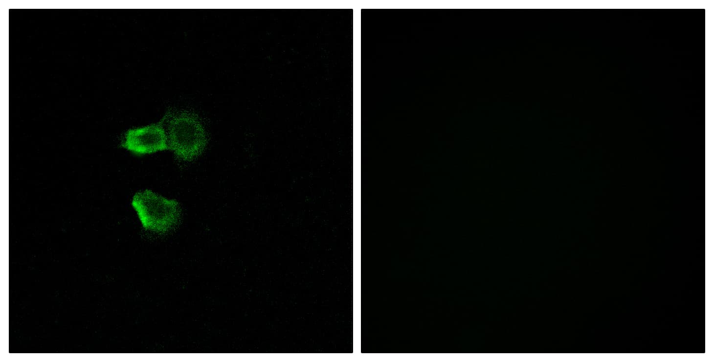 OR56B4 Antibody (aa241-290)