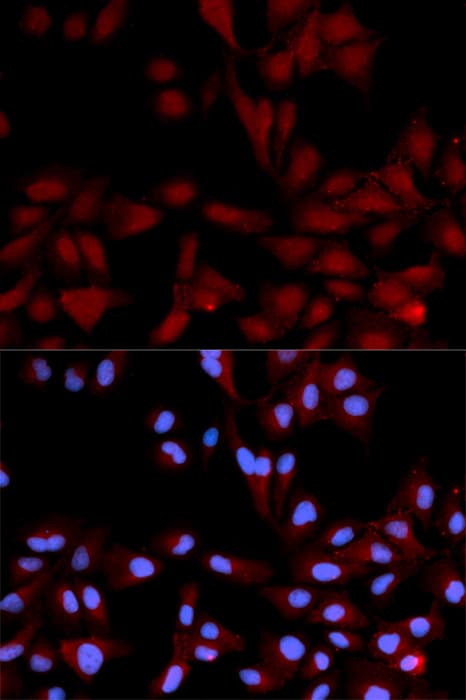 MAPK14 / p38 Antibody (phospho-Tyr182)