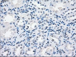 SORD / Sorbitol Dehydrogenase Antibody (clone OTI12A7)