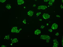 ATP5B / ATP Synthase Beta Antibody (clone OTI1F7, Carrier-free)