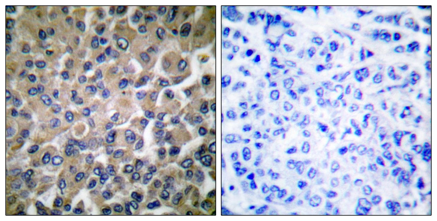 HSPA5 / GRP78 / BiP Antibody