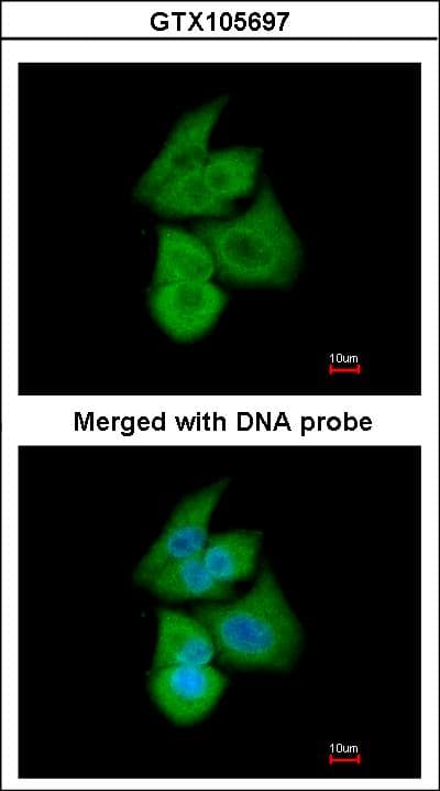 PFKL Antibody (aa428-674)