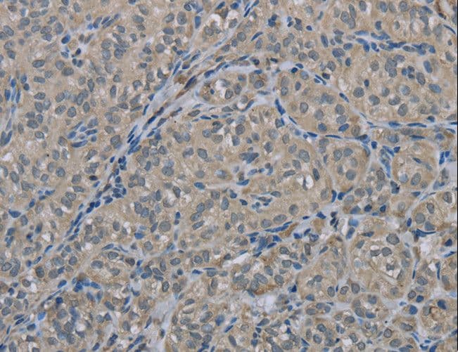 EDN1 / Endothelin 1 Antibody