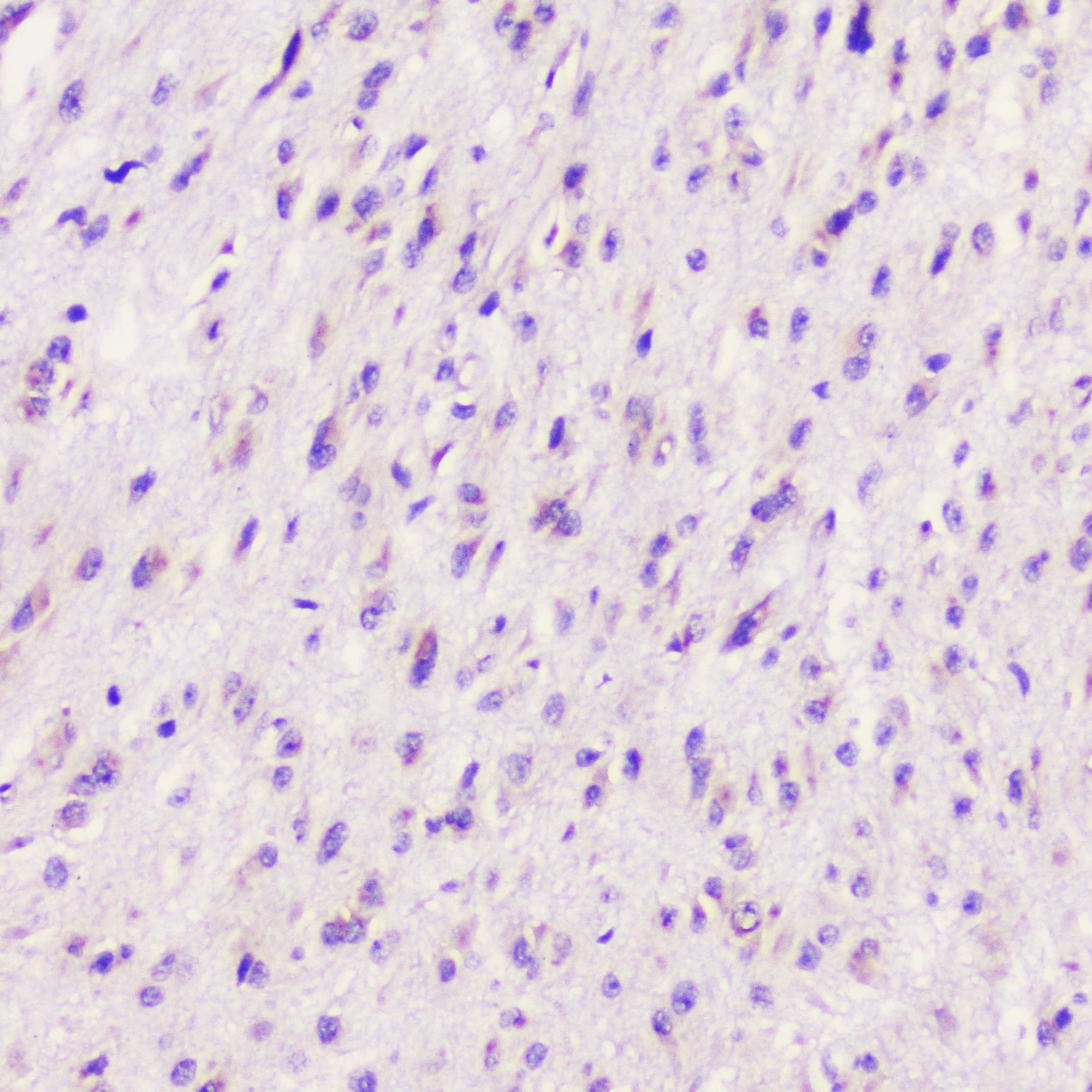 ELAVL2 / HUB Antibody