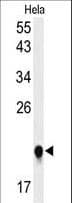 Polyclonal Rabbit anti-Human IMP3 Antibody (aa156-184, IHC, WB)