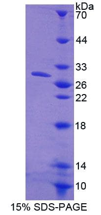 Human CPPED1 Protein (Recombinant His-T7, N-terminus)