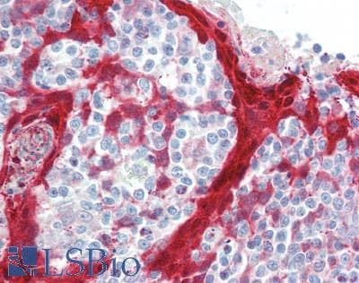 IHC-plus™ NLRP7 / NALP7 Antibody