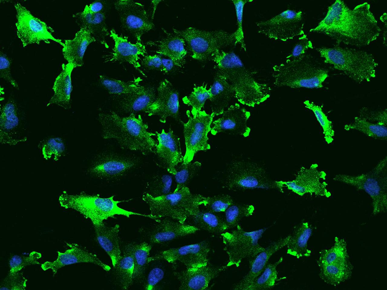PDAP1 Antibody