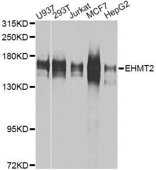 Polyclonal Rabbit anti-Human EHMT2 / G9A Antibody (IHC, WB)