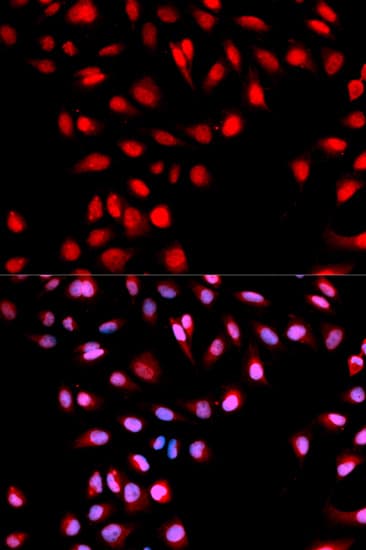 c-Met Antibody (phospho-Tyr1003)