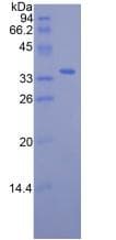Mouse RBP3 / IRBP Protein (Recombinant His)