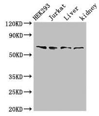 Polyclonal Rabbit anti-Human TXK / RLK Antibody (IHC, IF, WB)