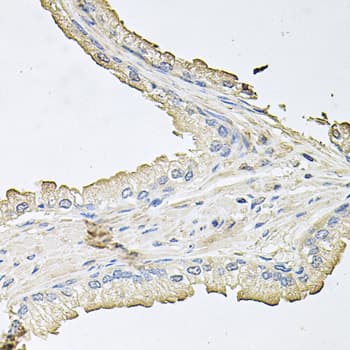AKT1 Antibody