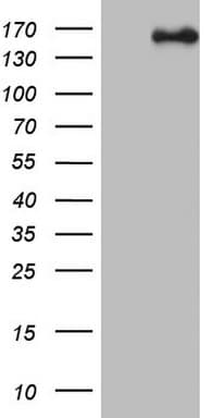 NCOA2 / TIF2 Antibody (aa1-280, clone OTI3C7)