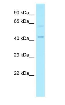 MMP25 / Leukolysin Antibody (aa235-284)