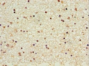 Polyclonal Rabbit anti-Human COT / CROT Antibody (aa1-87, IHC, WB)