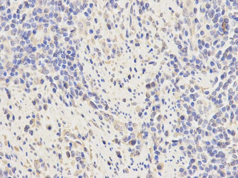 IHC-plus™ KPNA2 / Importin Alpha 1 Antibody